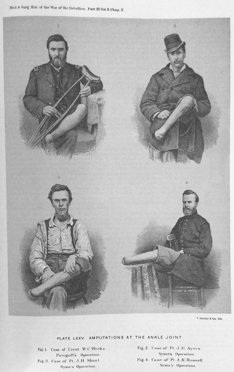 Woodcut illustration of amputees.