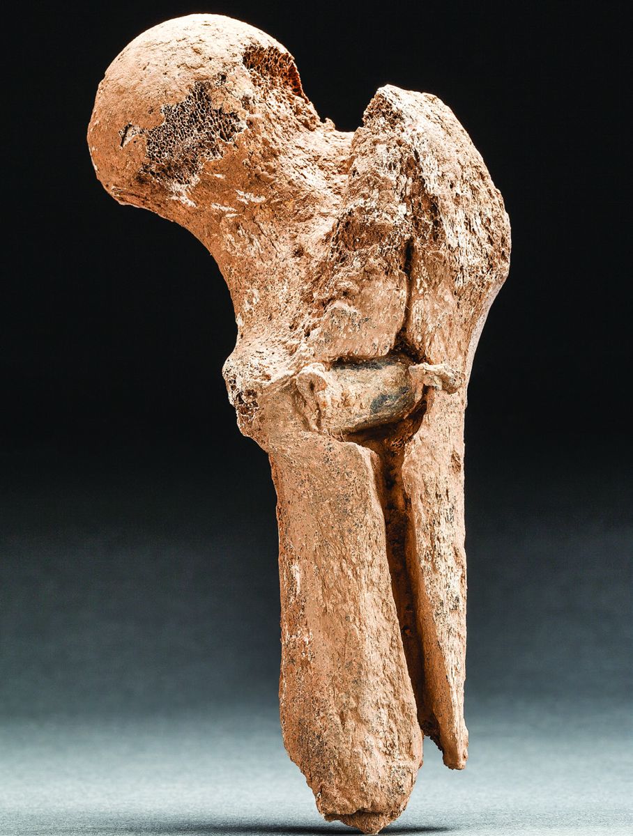 Left: An Enfield bullet embedded in the badly fractured right femur of one of the men dates the pit to the 1862 Battle of Second Manassas. Right: X-ray showing the position and distortion of the embedded bullet. (Smithsonian Institution)